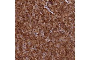 Immunohistochemical staining of human pancreas with DNAH10 polyclonal antibody  shows strong cytoplasmic positivity in exocrine glandular cells at 1:200-1:500 dilution. (DNAH10 anticorps)
