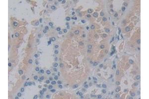 Detection of 15-LO-2 in Human Kidney Tissue using Polyclonal Antibody to 15-Lipoxygenase-2 (15-LO-2) (ALOX15B anticorps  (AA 253-490))