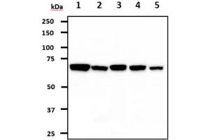 The cell lysates (40ug) were resolved by SDS-PAGE, transferred to PVDF membrane and probed with anti-human GARS (1:1000).