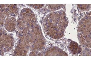 ABIN6277715 at 1/100 staining Human kidney tissue by IHC-P. (Nephrin anticorps)