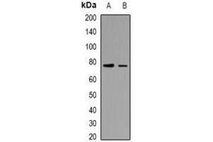 Western blot analysis of TRIF expression in HepG2 (A), Hela (B) whole cell lysates. (TICAM1 anticorps  (C-Term))