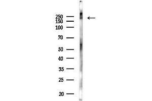 Western blot analysis of lysates from Hela cells(LPS 4h treatment), using TANC2 Antibody at 1/1000 dilution. (TANC2 anticorps)