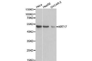 Western blot analysis of extracts of various cell lines, using KRT17 antibody.