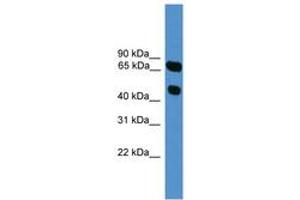 Image no. 1 for anti-Synaptotagmin XVI (SYT16) (AA 51-100) antibody (ABIN6746592) (SYT16 anticorps  (AA 51-100))
