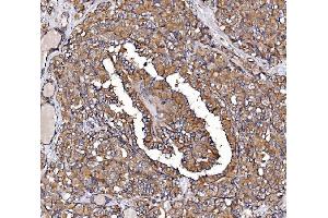 IHC analysis of GPR54/KISS1R using anti-GPR54/KISS1R antibody (ABIN7602153). (KISS1R anticorps  (AA 60-373))
