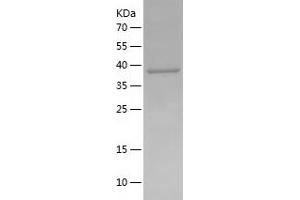 Western Blotting (WB) image for Chemokine (C-C Motif) Receptor-Like 2 (CCRL2) (AA 171-344) protein (His-IF2DI Tag) (ABIN7122316)