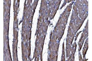 IHC analysis of CHCHD10 using anti-CHCHD10 antibody (ABIN7602507). (CHCHD10 anticorps  (AA 80-142))