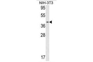 Image no. 1 for anti-Calponin 3, Acidic (CNN3) (Middle Region) antibody (ABIN452801) (CNN3 anticorps  (Middle Region))