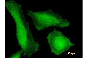Immunofluorescence of purified MaxPab antibody to TPD52 on HeLa cell.
