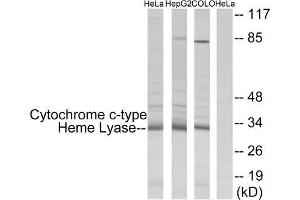 Western Blotting (WB) image for anti-Holocytochrome C Synthase (HCCS) (Internal Region) antibody (ABIN5977175) (HCCS anticorps  (Internal Region))