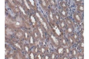 Detection of CAMK2a in Rat Kidney Tissue using Polyclonal Antibody to Calcium/Calmodulin Dependent Protein Kinase II Alpha (CAMK2a)