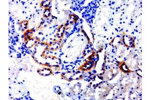Paraformaldehyde-fixed, paraffin embedded rat kidney, Antigen retrieval by boiling in sodium citrate buffer (pH6.