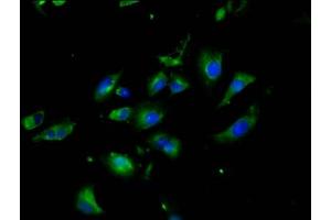 Immunofluorescence staining of U251 cells with ABIN7161318 at 1:200, counter-stained with DAPI. (Neuroligin 3 anticorps  (AA 642-783))