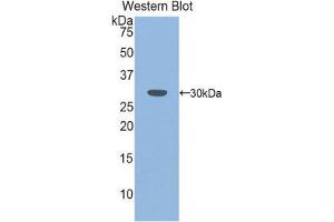 Western Blotting (WB) image for anti-Plastin 3 (PLS3) (AA 5-251) antibody (ABIN1860266) (Plastin 3 anticorps  (AA 5-251))