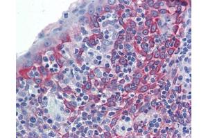 LIN7C antibody was used for immunohistochemistry at a concentration of 4-8 ug/ml. (LIN7C anticorps)