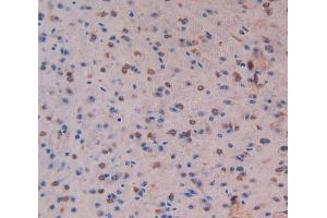 Used in DAB staining on fromalin fixed paraffin-embedded Liver tissue (MST1 anticorps  (AA 469-704))