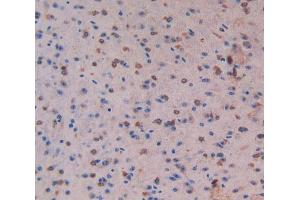 Used in DAB staining on fromalin fixed paraffin-embedded Liver tissue