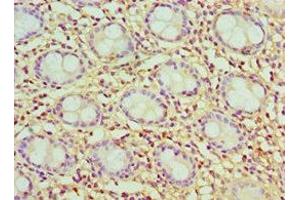 Immunohistochemistry of paraffin-embedded human colon tissue using ABIN7147595 at dilution of 1:100 (Cholecystokinin anticorps  (AA 21-115))