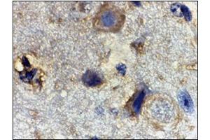 Immunohistochemistry of Rheb in mouse brain tissue with this product at 2 μg/ml. (RHEB anticorps  (Center))