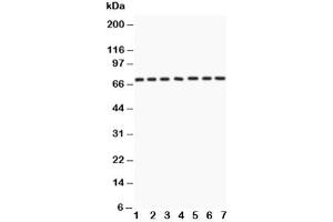 Western blot testing of Lamin A antibody and Lane 1:  human placenta (Lamin A/C anticorps  (AA 481-646))