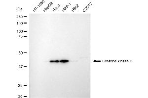 Western blotting analysis using creatine kinase B antibody (ABIN7798163). (Recombinant CKB anticorps)