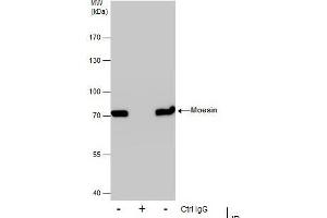 IP Image Immunoprecipitation of Moesin protein from A431 whole cell extracts using 5 μg of Moesin antibody [C2C3], C-term, Western blot analysis was performed using Moesin antibody [C2C3], C-term, EasyBlot anti-Rabbit IgG  was used as a secondary reagent. (Moesin anticorps  (C-Term))