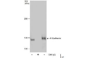 IP Image Immunoprecipitation of E-Cadherin protein from MCF-7 whole cell extracts using 5 μg of E-Cadherin antibody, Western blot analysis was performed using E-Cadherin antibody, EasyBlot anti-Rabbit IgG  was used as a secondary reagent. (E-cadherin anticorps)