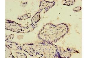 Immunohistochemistry of paraffin-embedded human placenta tissue using ABIN7172517 at dilution of 1:100