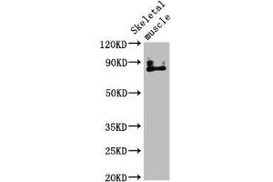 Western Blot Positive WB detected in: Mouse skeletal muscle tissue All lanes: TRPV2 antibody at 4. (TRPV2 anticorps  (AA 1-117))