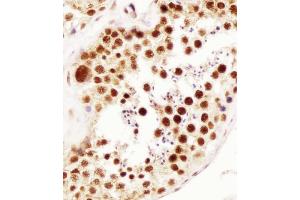 (ABIN652911 and ABIN2842587) staining ELAVL1 in human testis tissue sections by Immunohistochemistry (IHC-P - paraformaldehyde-fixed, paraffin-embedded sections).