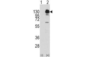 Western blot analysis of PDGFR alpha antibody and 293 cell lysate (2 ug/lane) either nontransfected (Lane 1) or transiently transfected with the human gene (2). (PDGFRA anticorps  (AA 740-769))