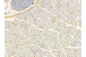 ABIN7095499 and ABIN7099556 at 1/100 staining mouse muscle tissue by IHC-P.