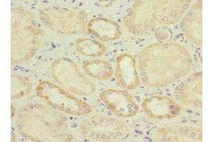 Immunohistochemistry of paraffin-embedded human kidney tissue using ABIN7156807 at dilution of 1:100 (IL17 Receptor B anticorps  (AA 18-292))