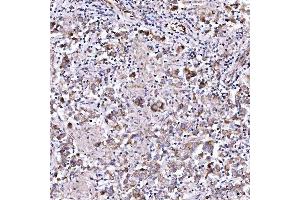 IHC analysis of RAB3GAP1 using anti-RAB3GAP1 antibody (ABIN7599702). (RAB3GAP1 anticorps  (AA 109-810))