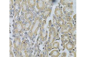 Immunohistochemistry of paraffin-embedded Rat kidney using PDGFB Polyclonal Antibody at dilution of 1:100 (40x lens). (PDGFB anticorps)