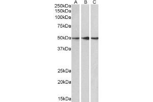 ABIN2564672 (0. (PPP2R5E anticorps  (C-Term))