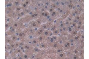 DAB staining on IHC-P; Samples: Mouse Liver Tissue (IL-22 anticorps  (AA 34-179))