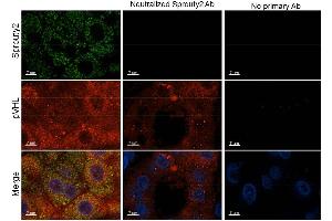 Immunohistochemistry of Rabbit anti-Sprouty2 antibody. (SPRY2 anticorps  (Internal Region))