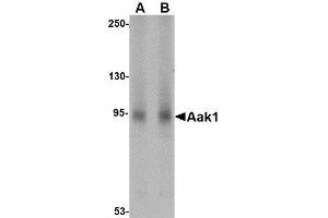 Western blot analysis of Aak1 in A-20 lysate with AP30003PU-N Aak1 antibody at (A) 1 and (B) 2 μg/ml. (AAK1 anticorps  (N-Term))