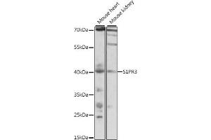 Western blot analysis of extracts of various cell lines, using S1PR3 antibody (ABIN7270535) at 1:1000 dilution.