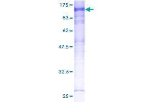 Image no. 1 for Microtubule Associated serine/threonine Kinase-Like (MASTL) (AA 1-879) protein (GST tag) (ABIN1310430)