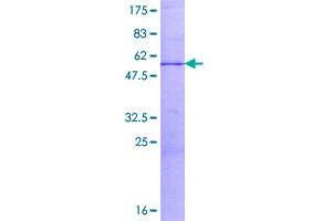 Image no. 1 for Charged Multivesicular Body Protein 1A (CHMP1A) (AA 1-196) protein (GST tag) (ABIN1349350)