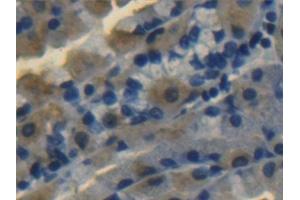 Detection of ALDH1A1 in Human Stomach Tissue using Polyclonal Antibody to Aldehyde Dehydrogenase 1 Family, Member A1 (ALDH1A1)