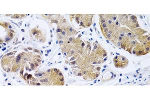 Immunohistochemistry of paraffin-embedded Human stomach using PTGIR Polyclonal Antibody at dilution of 1:200 (40x lens). (Prostacyclin Receptor anticorps)