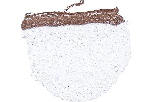 Uterus ectocervix (Recombinant Keratin 6 anticorps)