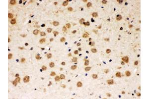 ABR was detected in paraffin-embedded sections of rat brain tissues using rabbit anti- ABR Antigen Affinity purified polyclonal antibody (Catalog # ) at 1 µg/mL.