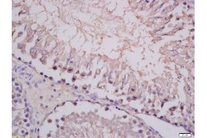 Formalin-fixed and paraffin embedded rat testis tissue labeled with Anti-COMMD4 Polyclonal Antibody, Unconjugated 1:400 followed by conjugation to the secondary antibody and DAB staining.