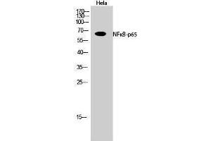 Western Blotting (WB) image for anti-Nuclear Factor-kB p65 (NFkBP65) (Thr72) antibody (ABIN3176327) (NF-kB p65 anticorps  (Thr72))