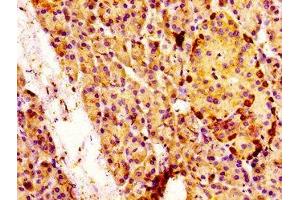 IHC image of ABIN7160041 diluted at 1:100 and staining in paraffin-embedded human pancreatic tissue performed on a Leica BondTM system. (MAP3K4 anticorps  (AA 53-145))