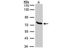 ZNF45 antibody